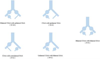 Single-Center Experience in the Endovascular Management of the Combination of Isolated Common and Internal Iliac Artery Aneurysms